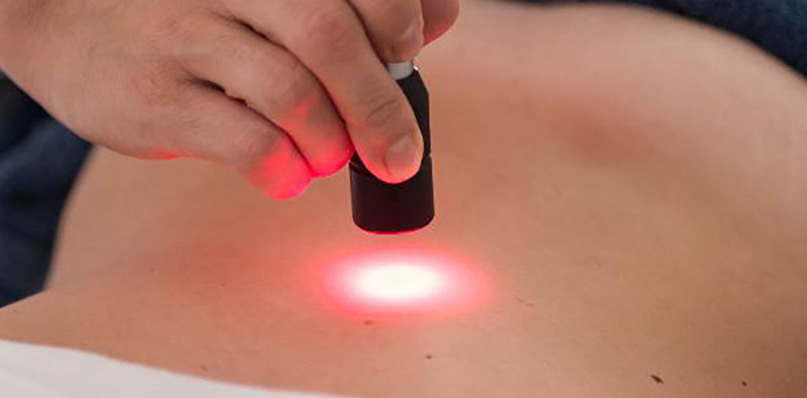 Fisioterapia laserterapia